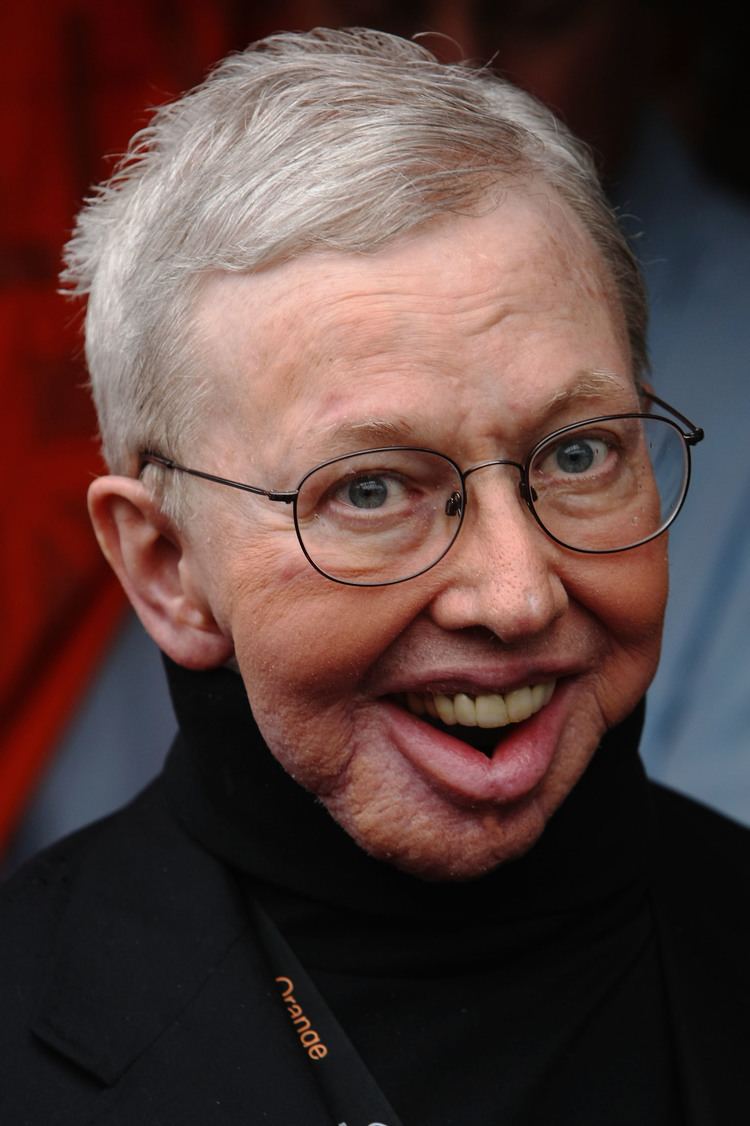 Roger Ebert Jaw Reconstruction