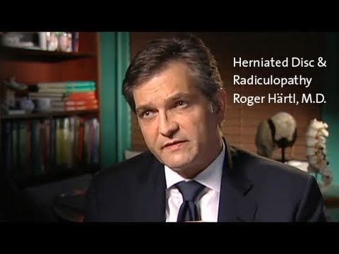 Roger Härtl Herniated Disc and Radiculopathy Dr Roger Hartl YouTube