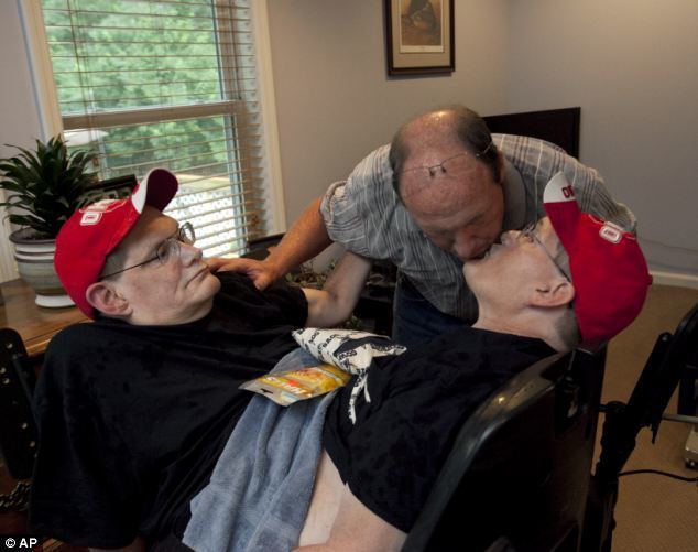 Ronnie and Donnie Galyon Ohio conjoined twins Ronnie and Donnie Galyon 62 prepare
