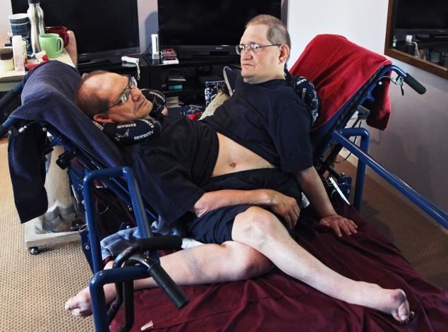 Ronnie and Donnie Galyon Ronnie Donnie Galyon become oldest conjoined twins NY