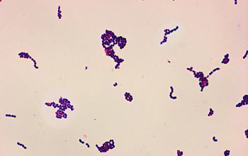 Rothia (bacteria) microbecanvascomadminuploadsimagebacterienr