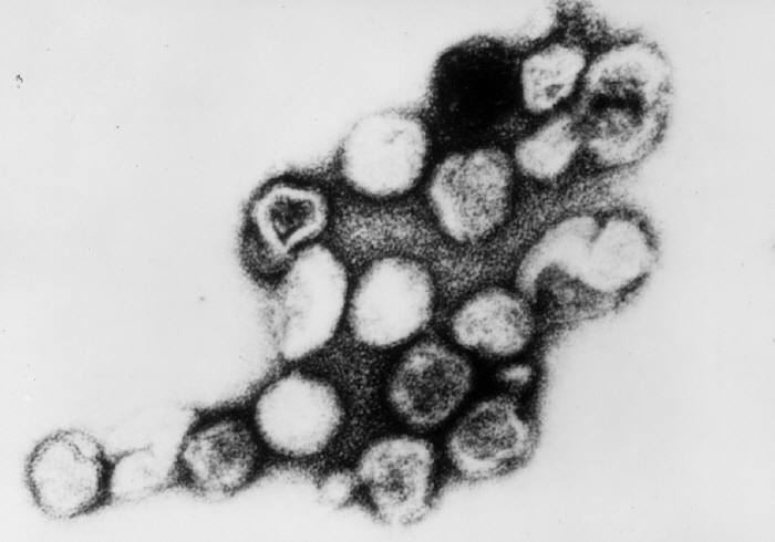 Rubella virus Rubella virus Wikipedia