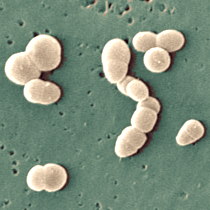 Rubrobacter httpsmicrobewikikenyoneduimages882Rubobac