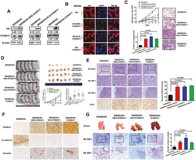 S100A11 LASP1S100A11 axis promotes colorectal cancer aggressiveness by