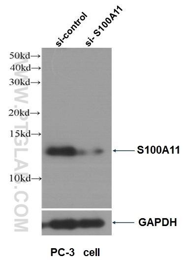 S100A11 S100A11 Antibody 102371AP Proteintech
