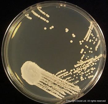 Sabouraud agar CM0041 Sabouraud Dextrose Agar Oxoid Product Detail