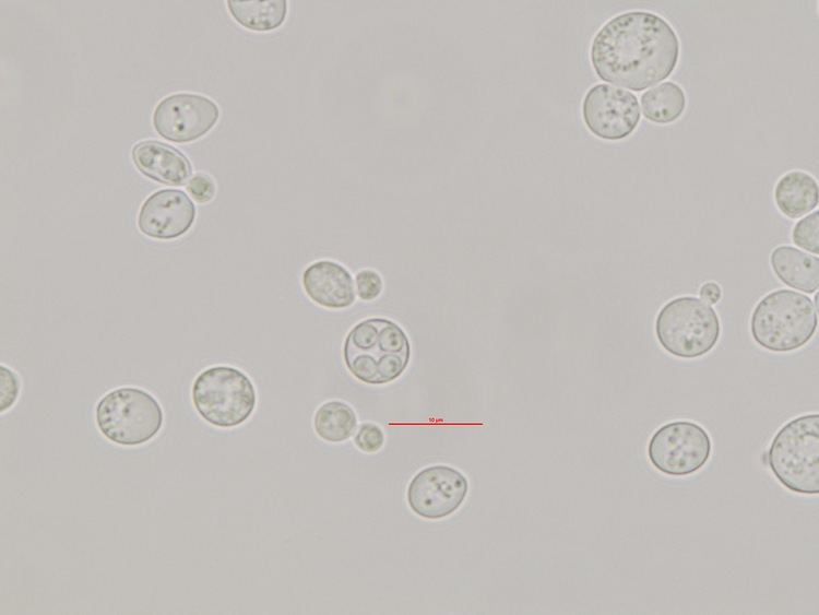 Saccharomyces bayanus Retina Saccharomyces bayanus