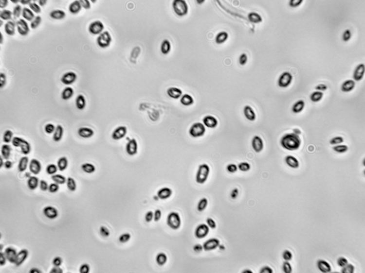 Saccharomyces cerevisiae Saccharomyces cerevisiae Viticulture amp Enology