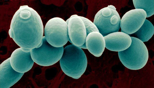 Saccharomyces cerevisiae The wonderful world of the yeast Saccharomyces cerevisiaea