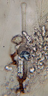 Saksenaea zygomycetesorgimages70jpg