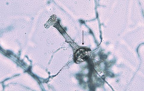 Saksenaea vasiformis httpswwwmjacomausitesdefaultfilesissues