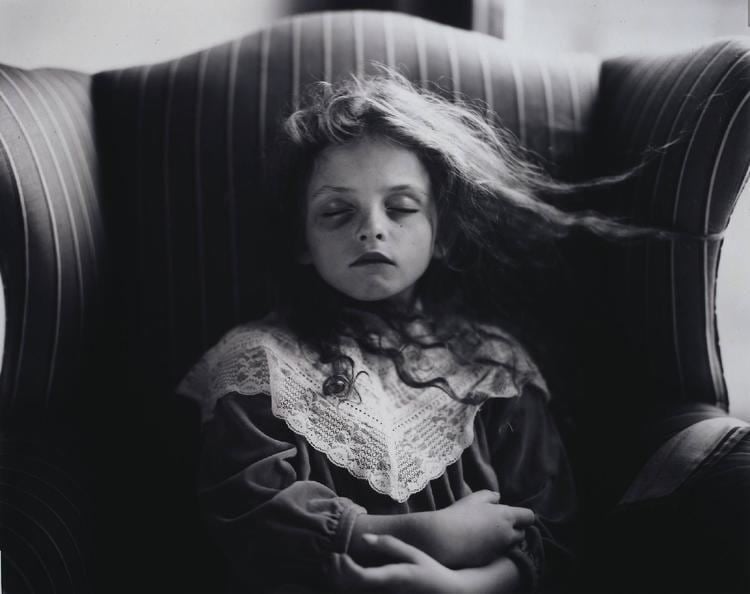 Virginia Mann, Sally Mann's daughter featured on her art called Black Eye, 1992.