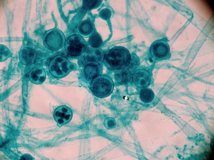 Microscopy showed Saprolegnia parasite in fish Wallago Attu