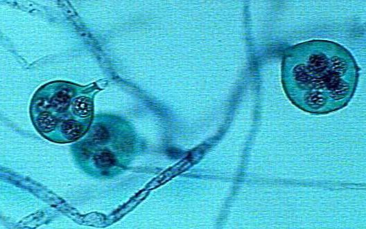 Microscopic view of Saprolegnia