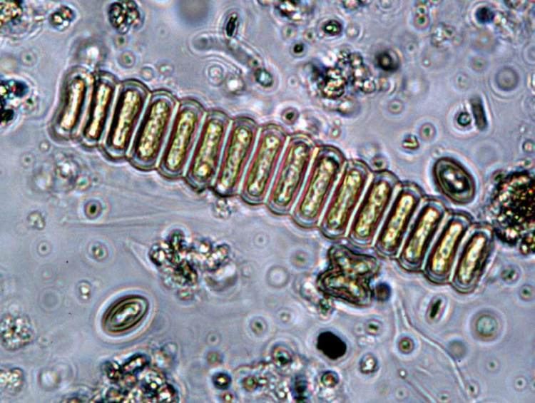 Microscopic view of Scenedesmus bijunga