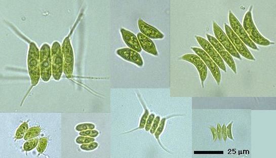 Different sizes of Scenedesmus, a green algae