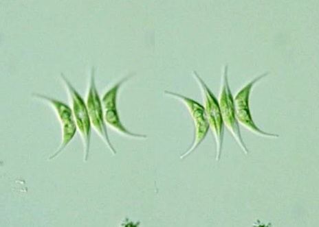 Scenedesmus acuminatus Protist Images Scenedesmus acuminatus