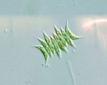 Scenedesmus acuminatus Protist Images Scenedesmus acuminatus