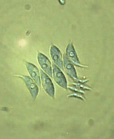 Scenedesmus acuminatus httpsuploadwikimediaorgwikipediacommonsbb