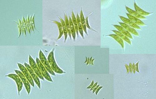 Scenedesmus acuminatus Protist Images Scenedesmus acuminatus