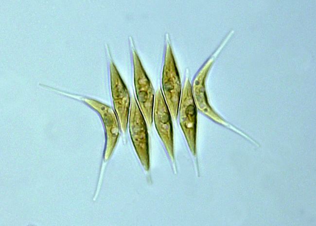 Scenedesmus, a green algae