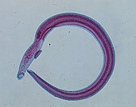 Schistosoma haematobium wwwmedcmuacthdeptparasitetrematodes191jpg