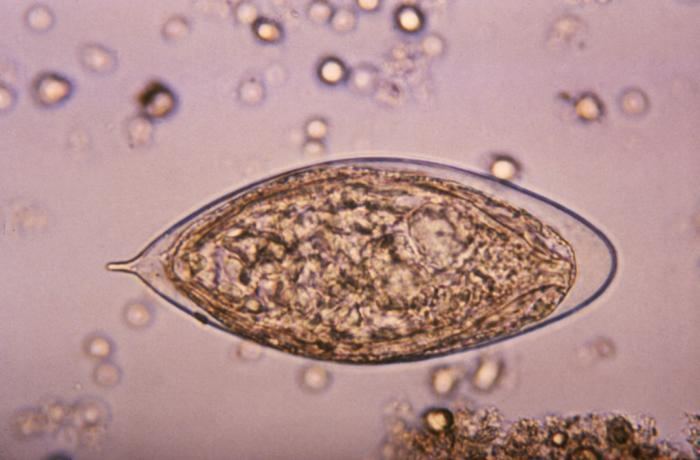 Schistosoma haematobium egg 4843 lores.jpg