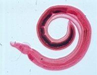Schistosoma japonicum wwwymedutwparhtmlParPicHelminthesTrematode