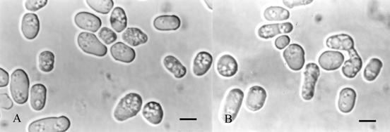 Schizosaccharomyces pombe Ascomycota gtgt Schizosaccharomycetes gtgt Schizosaccharomycetales