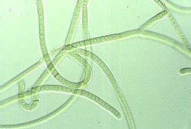 Scytonema varium algaemdPhotoaspxid1390ampn2524173249