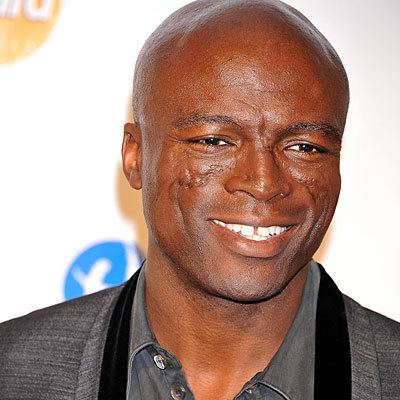 Seal (musician) Neiman Dermatology and Hair Transplantation Singer Seal39s