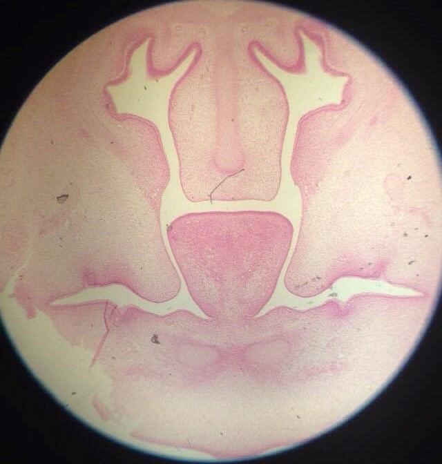 Secondary palate development