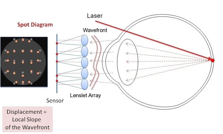 Shack–Hartmann wavefront sensor