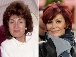 Sharon Osbourne Sharon Osbourne Plastic Surgery Before And After Pictures