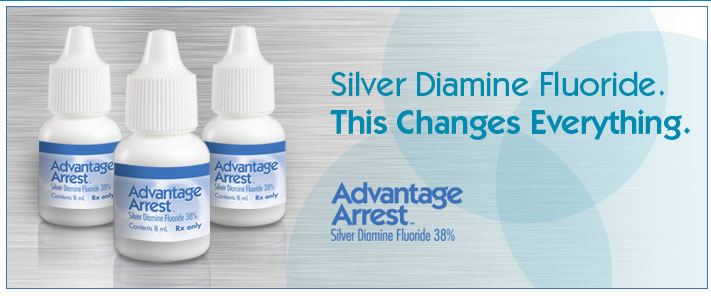 Silver diammine fluoride Silver Diamine Fluoride SDF Rockville Pediatric Dental