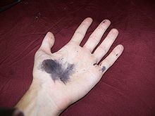 Silver nitrate Silver nitrate Wikipedia