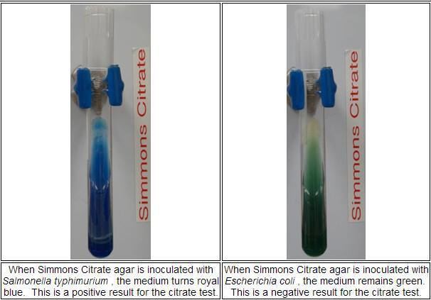 Simmons' citrate agar Simmons Citrate Agar Medical Laboratories