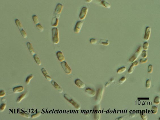 Skeletonema marinoi Skeletonema marinoidohrnii complex Algae Pinterest
