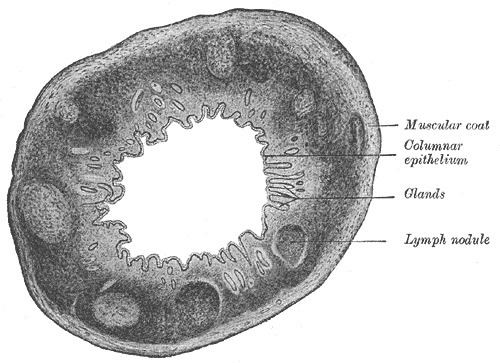 Solitary lymphatic nodule