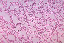 Sphingobacteria (phylum) httpsuploadwikimediaorgwikipediacommonsthu