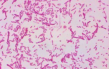 Sphingobacterium microbecanvascomadminuploadsimagebacteriens