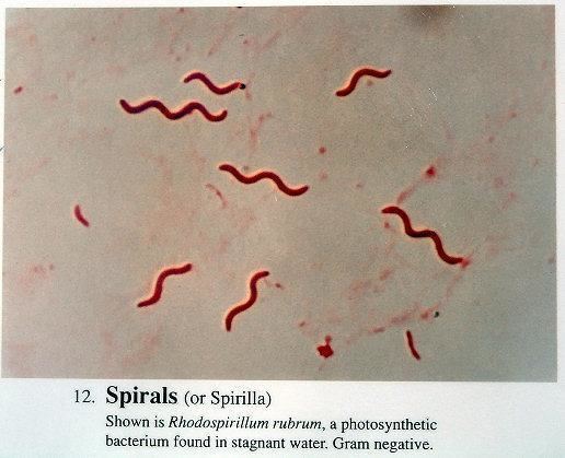 Spiral bacteria Photo Album Part I Spiral Bacteria