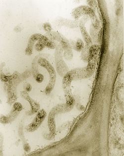 Spiroplasma httpsuploadwikimediaorgwikipediacommonsthu