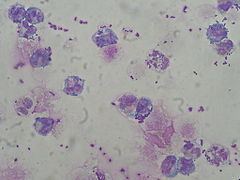Staphylococcus capitis httpsuploadwikimediaorgwikipediacommonsthu