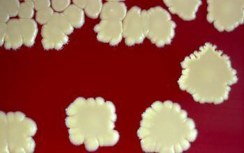 Staphylococcus gallinarum microbecanvascomadminuploadsimagebacteriens