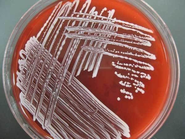 Staphylococcus hyicus marphavetcomuploadsnews201610staphylococcus