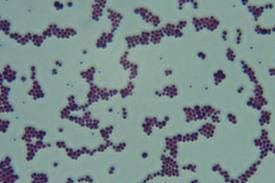 Staphylococcus intermedius httpsopenlabcitytechcunyedusmythmicrobiolog
