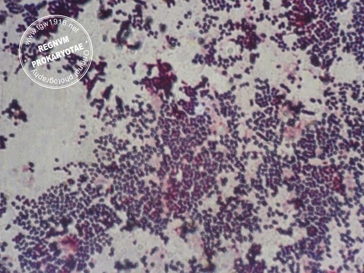 Staphylococcus lentus wwwtgw1916netimagesmicrStaphylococcuslentusjpg