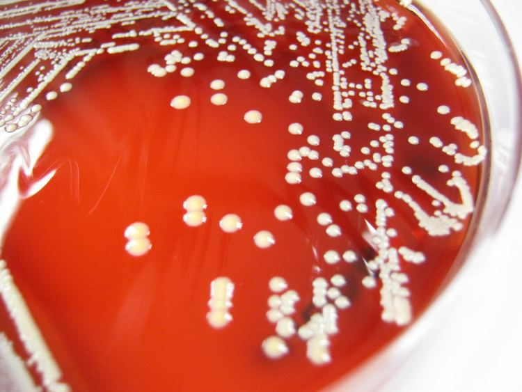 Staphylococcus lugdunensis httpsc1staticflickrcom437759674809423f420