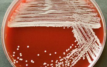 Staphylococcus saprophyticus on agar plate